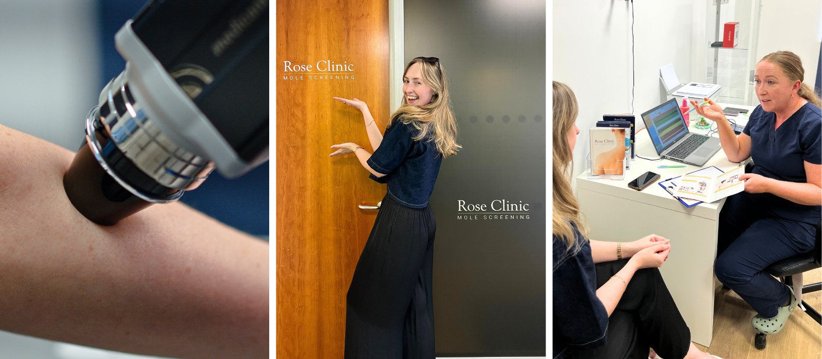 I tried a mole mapping service – here’s everything you need to know